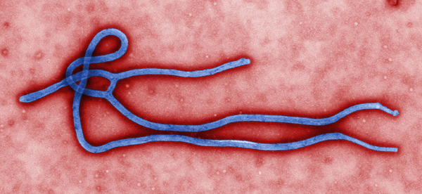 This tiny, worm-like Ebola virus can be lethal. Photo in the public domain, provided by the Centers for Disease Control and Prevention. 