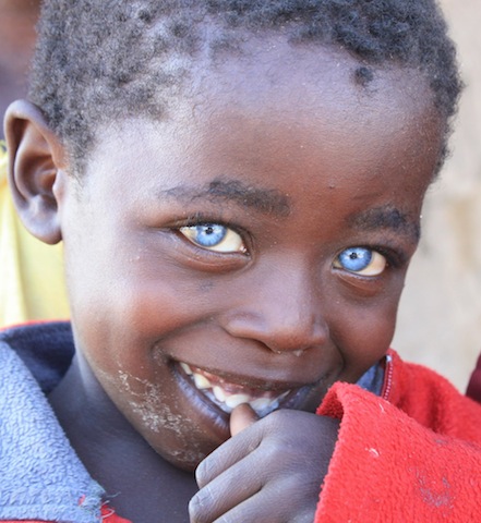 african baby with blue eyes