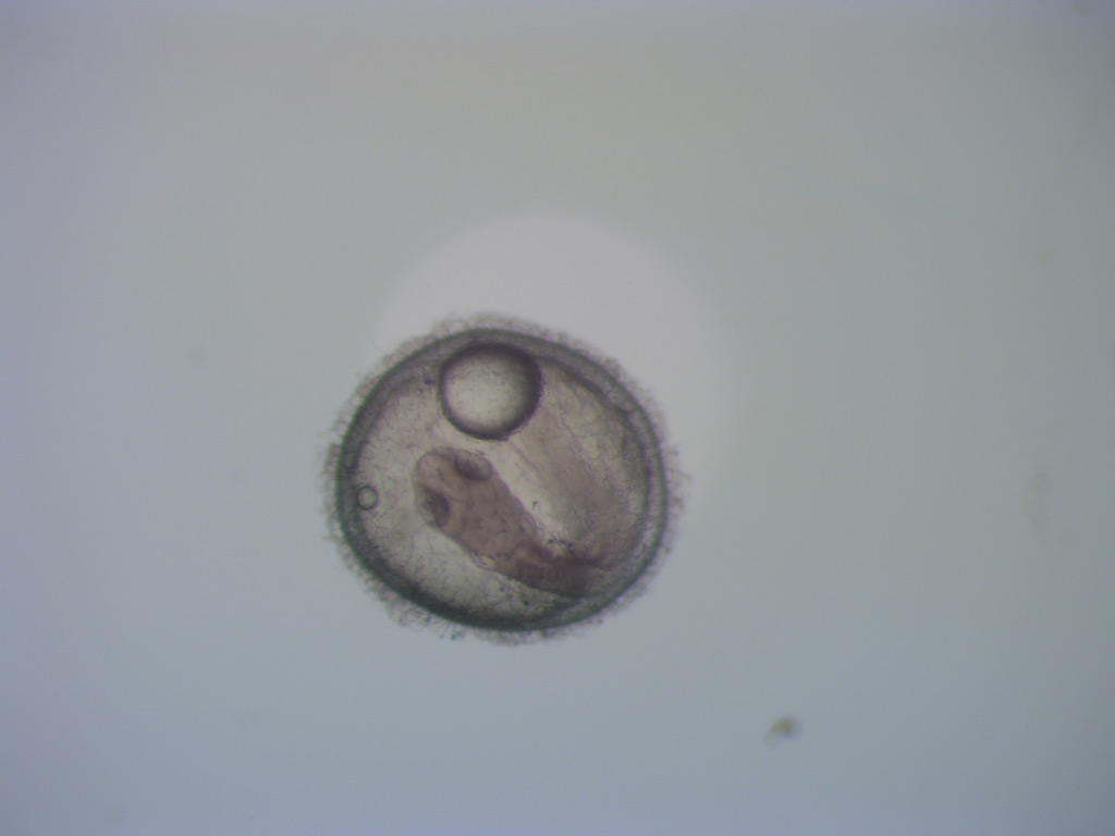 Killifish embryo