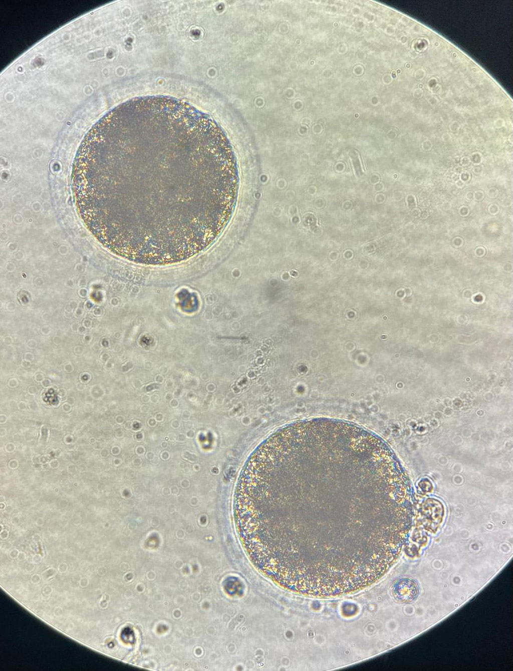 Hemmersbach and University of Pretoria